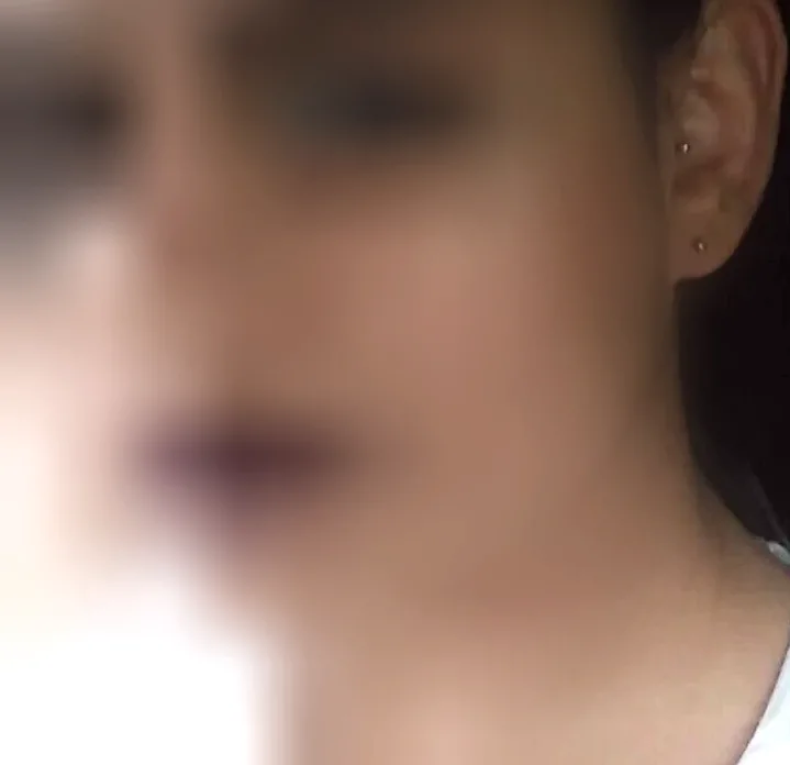 Emilia, 38